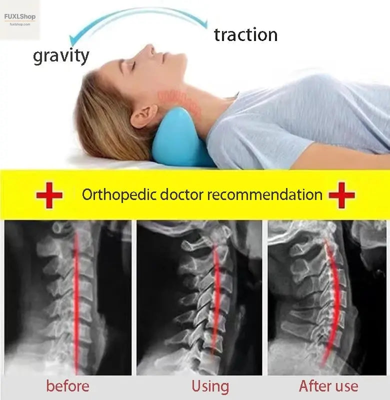 Neck Shoulder Stretcher Relaxer Cervical Chiropractic Traction Device Massage Pillow for Pain Relief Cervical Spine Alignment - FUXL-Shopify