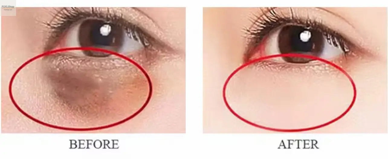 OTVENA Anti-Wrinkle Augencreme - Sofortige Jugendlichkeit für Ihre Haut! - FUXL-Shopify