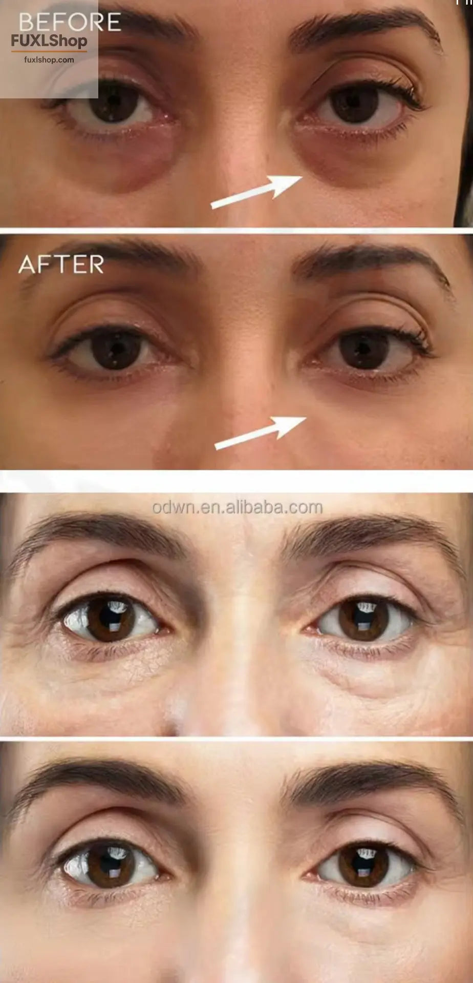 OTVENA Anti-Wrinkle Augencreme - Sofortige Jugendlichkeit für Ihre Haut! - FUXL-Shopify