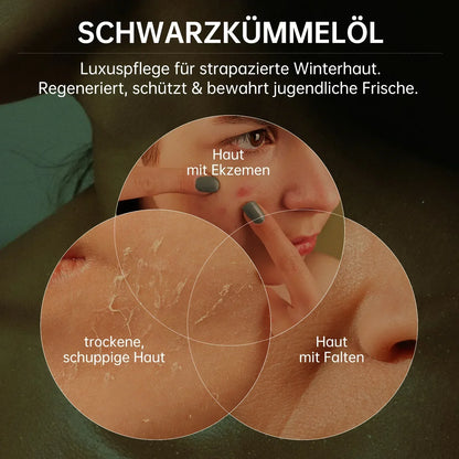 Schwarzkümmelöl Kapseln 120 Stück 1000mg Tagesdosis Immunsystem Atemwege Hergestellt in DE - FUXLShop