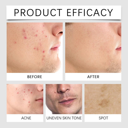 BB Cream für Männer – Langanhaltende Abdeckung & Mattierender Effekt - FUXL-Shopify 
